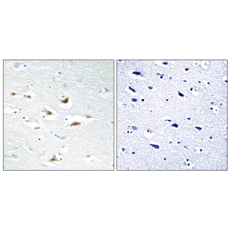 Immunohistochemistry - Anti-Catenin-beta Antibody (B7022) - Antibodies.com