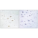 Immunohistochemistry - Anti-Catenin-beta Antibody (B7022) - Antibodies.com