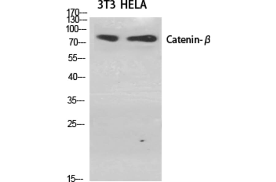 Western Blot - Anti-Catenin-beta Antibody (B7022) - Antibodies.com