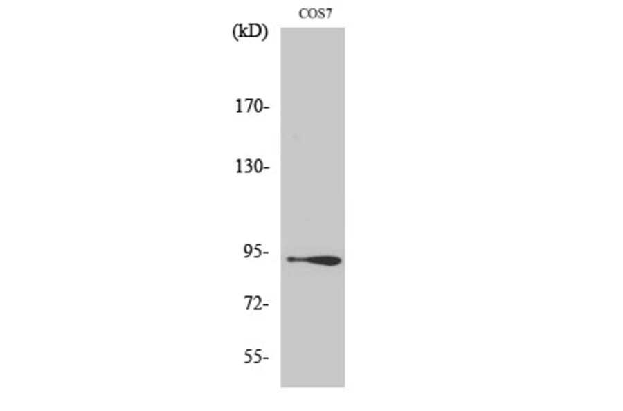 Western Blot - Anti-Catenin-beta Antibody (B7022) - Antibodies.com