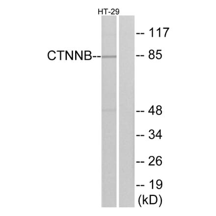 Western Blot - Anti-Catenin-beta Antibody (B7023) - Antibodies.com