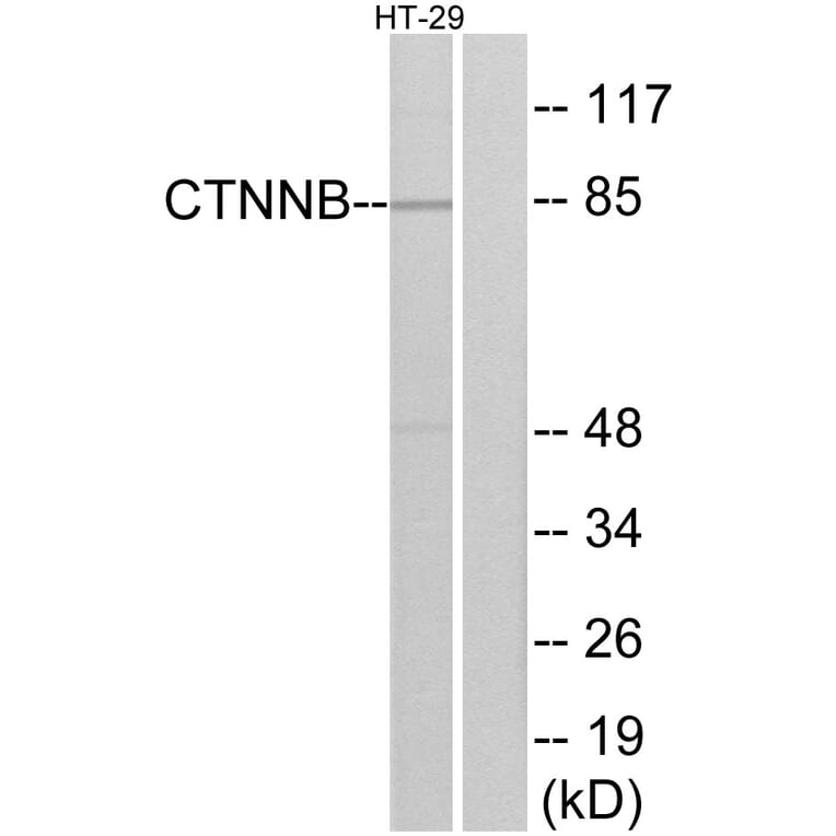 Western Blot - Anti-Catenin-beta Antibody (B7023) - Antibodies.com