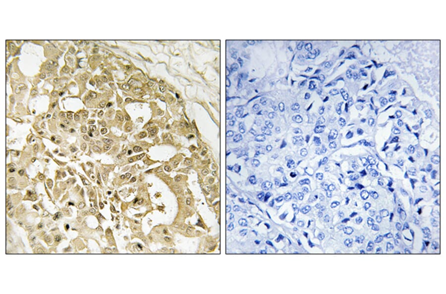 Immunohistochemistry - Anti-Catenin-beta Antibody (B7023) - Antibodies.com