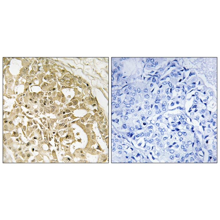 Immunohistochemistry - Anti-Catenin-beta Antibody (B7023) - Antibodies.com