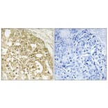 Immunohistochemistry - Anti-Catenin-beta Antibody (B7023) - Antibodies.com