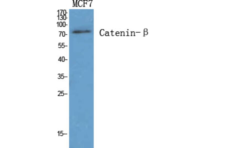 Western Blot - Anti-Catenin-beta Antibody (B7023) - Antibodies.com