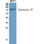 Western Blot - Anti-Catenin-beta Antibody (B7023) - Antibodies.com