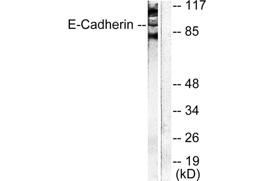 Western Blot - Anti-Cadherin-pan Antibody (C0148) - Antibodies.com