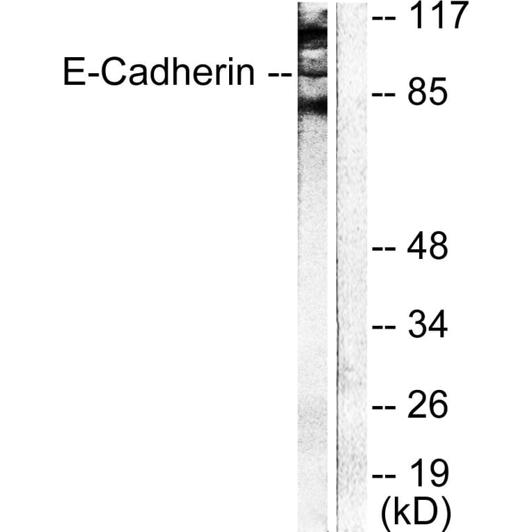 Western Blot - Anti-Cadherin-pan Antibody (C0148) - Antibodies.com