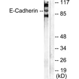 Western Blot - Anti-Cadherin-pan Antibody (C0148) - Antibodies.com