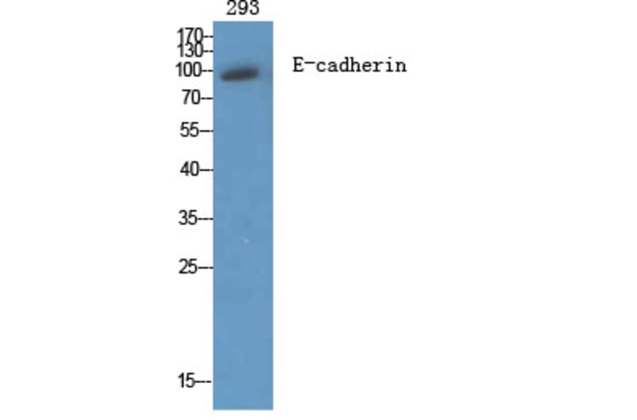 Western Blot - Anti-Cadherin-pan Antibody (C0148) - Antibodies.com