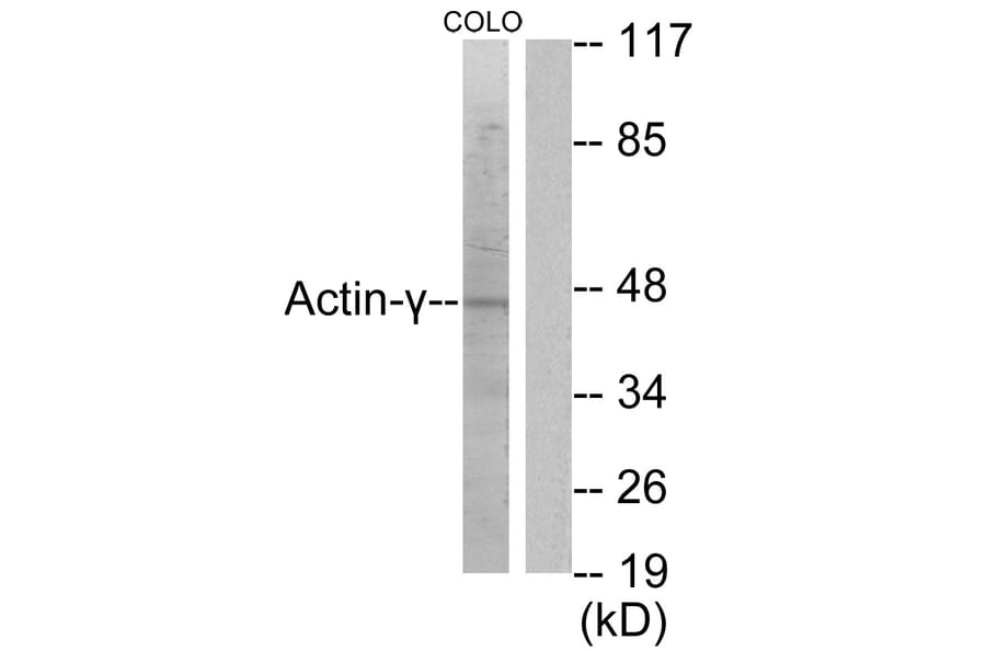 Western Blot - Anti-Actin-gamma2 Antibody (C0123) - Antibodies.com