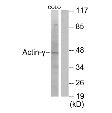 Western Blot - Anti-Actin-gamma2 Antibody (C0123) - Antibodies.com