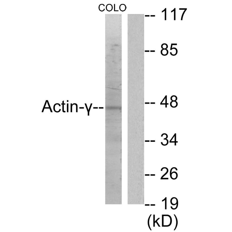 Western Blot - Anti-Actin-gamma2 Antibody (C0123) - Antibodies.com
