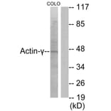 Western Blot - Anti-Actin-gamma2 Antibody (C0123) - Antibodies.com