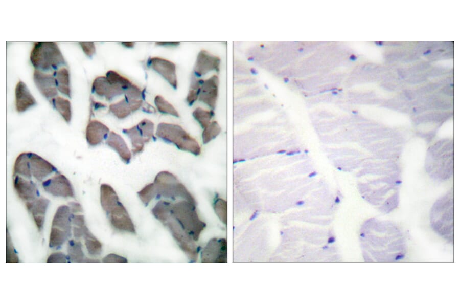 Immunohistochemistry - Anti-Actin-gamma2 Antibody (C0123) - Antibodies.com