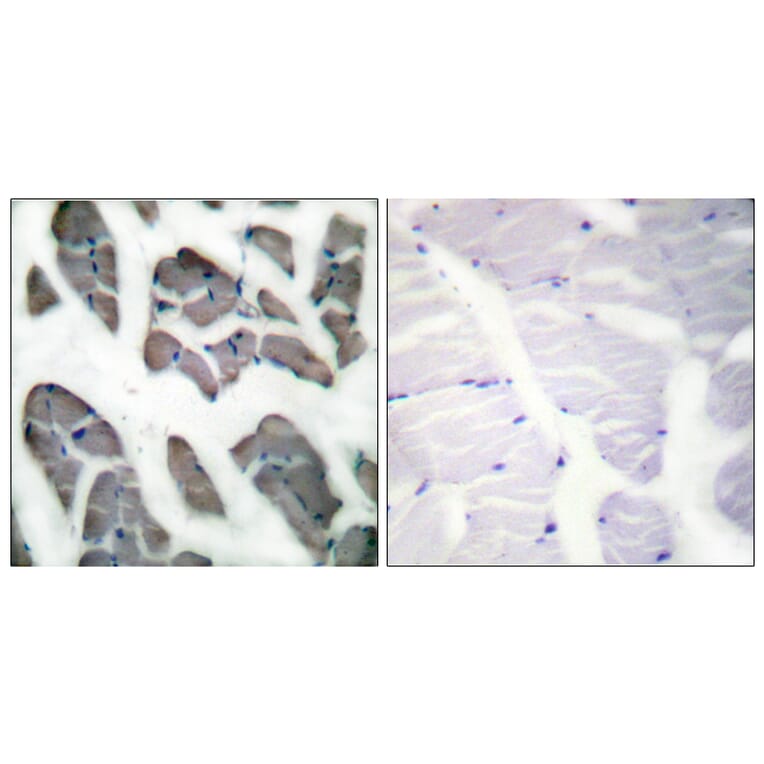 Immunohistochemistry - Anti-Actin-gamma2 Antibody (C0123) - Antibodies.com