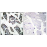 Immunohistochemistry - Anti-Actin-gamma2 Antibody (C0123) - Antibodies.com