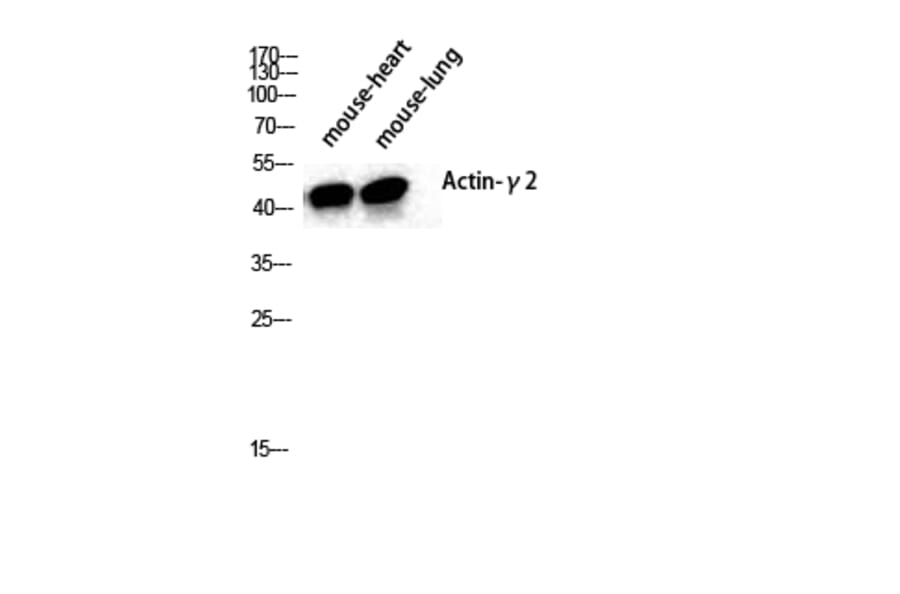 Western Blot - Anti-Actin-gamma2 Antibody (C0123) - Antibodies.com