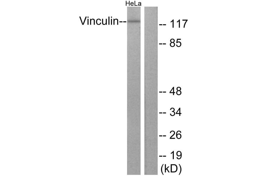 Western Blot - Anti-Vinculin Antibody (B1017) - Antibodies.com