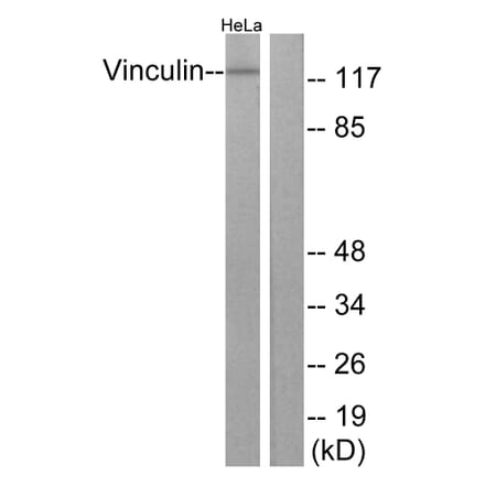 Western Blot - Anti-Vinculin Antibody (B1017) - Antibodies.com