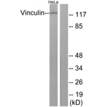 Western Blot - Anti-Vinculin Antibody (B1017) - Antibodies.com
