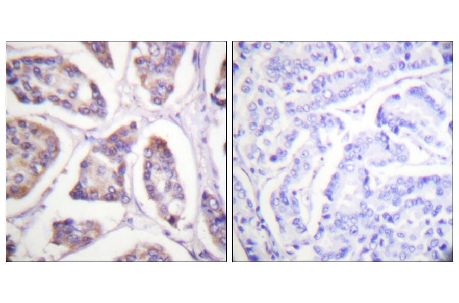 Immunohistochemistry - Anti-Vinculin Antibody (B1017) - Antibodies.com
