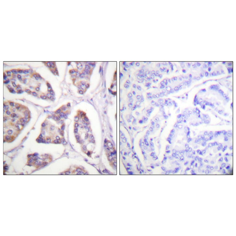 Immunohistochemistry - Anti-Vinculin Antibody (B1017) - Antibodies.com