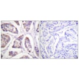 Immunohistochemistry - Anti-Vinculin Antibody (B1017) - Antibodies.com