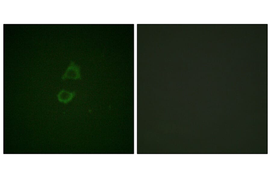 Immunofluorescence - Anti-Vinculin Antibody (B1017) - Antibodies.com