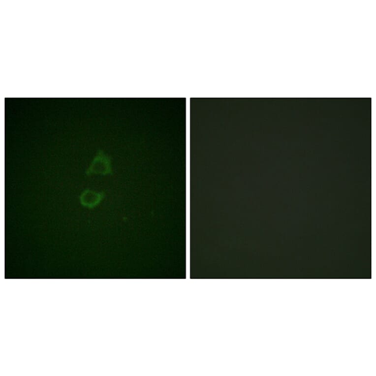 Immunofluorescence - Anti-Vinculin Antibody (B1017) - Antibodies.com