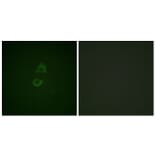 Immunofluorescence - Anti-Vinculin Antibody (B1017) - Antibodies.com