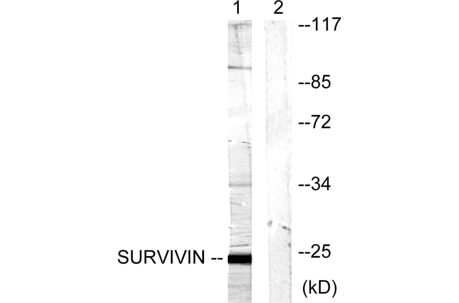 Western Blot - Anti-Survivin Antibody (B0579) - Antibodies.com
