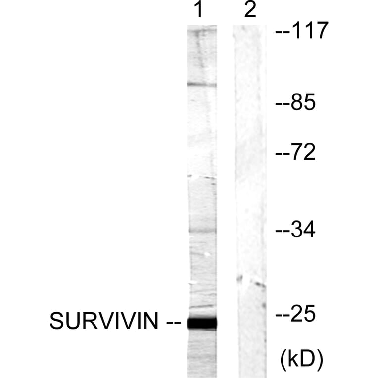 Western Blot - Anti-Survivin Antibody (B0579) - Antibodies.com