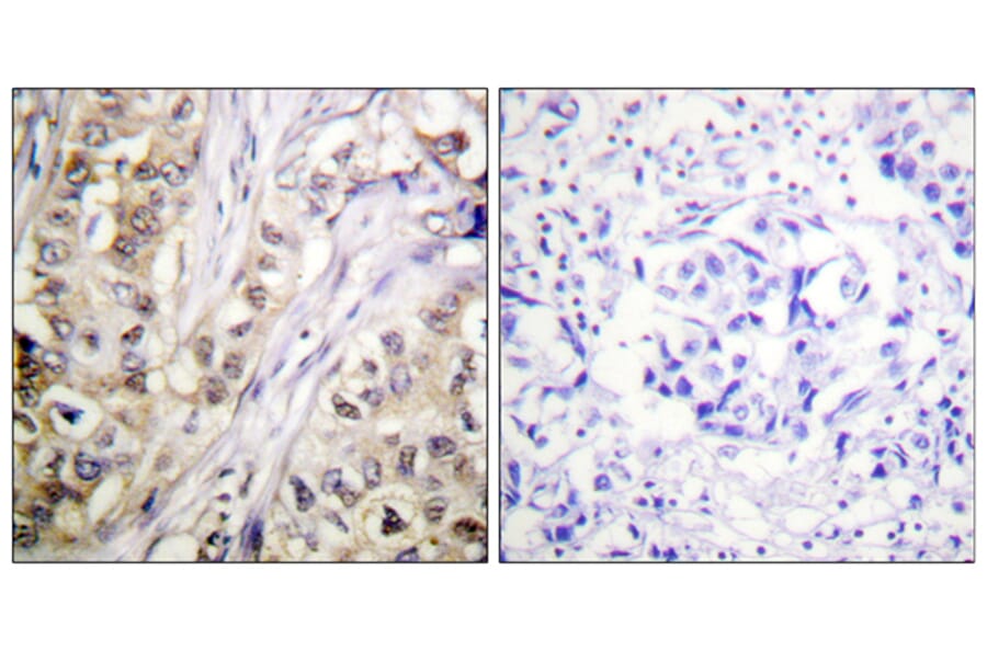 Immunohistochemistry - Anti-Survivin Antibody (B0579) - Antibodies.com