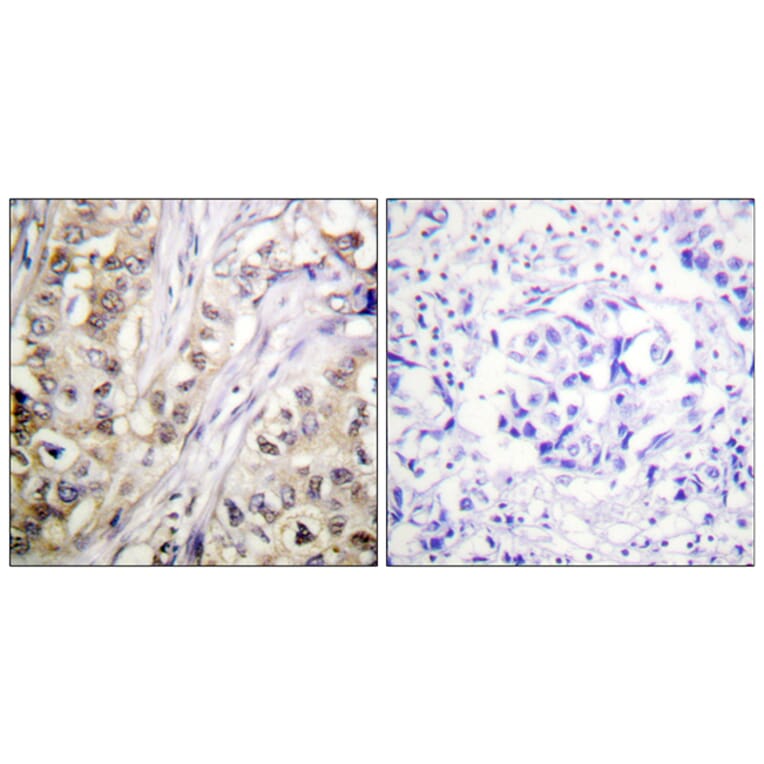 Immunohistochemistry - Anti-Survivin Antibody (B0579) - Antibodies.com