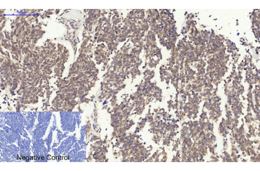 Immunohistochemistry - Anti-Survivin Antibody (B0579) - Antibodies.com