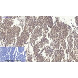 Immunohistochemistry - Anti-Survivin Antibody (B0579) - Antibodies.com