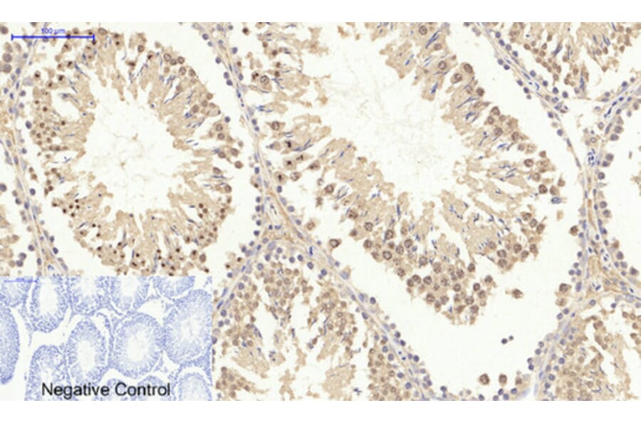 Immunohistochemistry - Anti-Survivin Antibody (B0579) - Antibodies.com