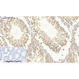 Immunohistochemistry - Anti-Survivin Antibody (B0579) - Antibodies.com