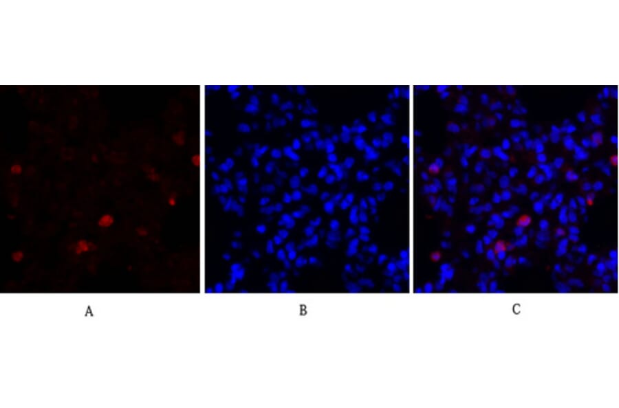Immunofluorescence - Anti-Survivin Antibody (B0579) - Antibodies.com