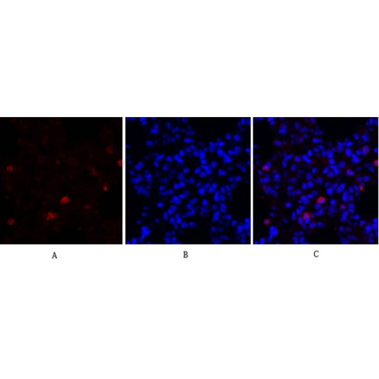 Immunofluorescence - Anti-Survivin Antibody (B0579) - Antibodies.com