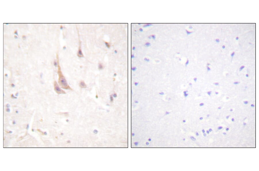 Immunohistochemistry - Anti-PKC zeta Antibody (B0805) - Antibodies.com