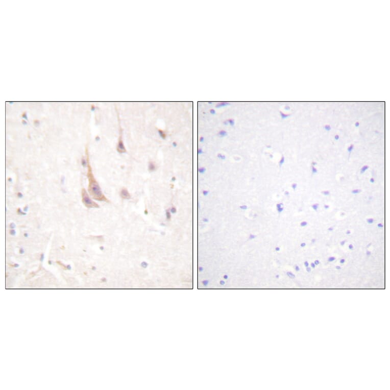 Immunohistochemistry - Anti-PKC zeta Antibody (B0805) - Antibodies.com