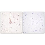 Immunohistochemistry - Anti-PKC zeta Antibody (B0805) - Antibodies.com