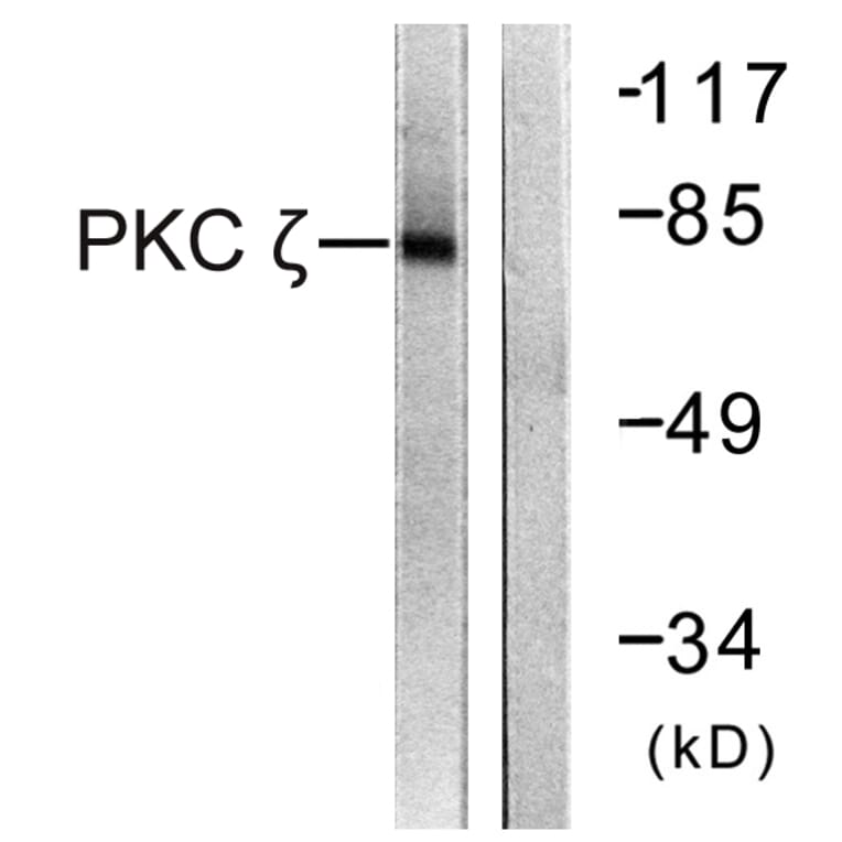 Western Blot - Anti-PKC zeta Antibody (B0805) - Antibodies.com