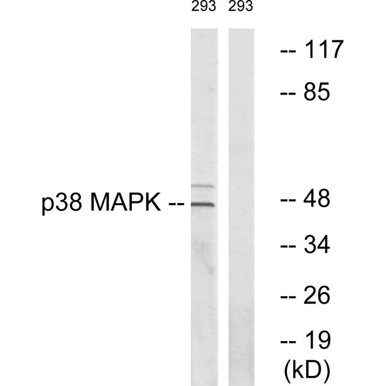 Western Blot - Anti-p38 MAPK Antibody (B0798) - Antibodies.com