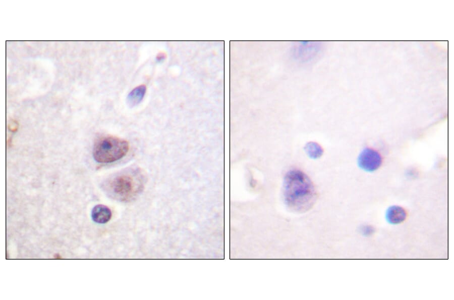 Immunohistochemistry - Anti-p38 MAPK Antibody (B0798) - Antibodies.com