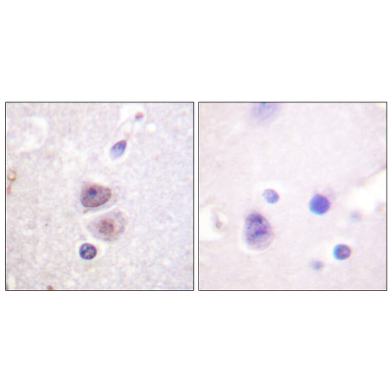 Immunohistochemistry - Anti-p38 MAPK Antibody (B0798) - Antibodies.com