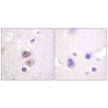 Immunohistochemistry - Anti-p38 MAPK Antibody (B0798) - Antibodies.com